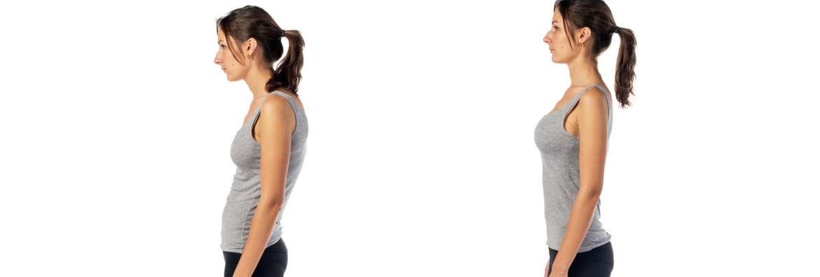 Before and after bad posture