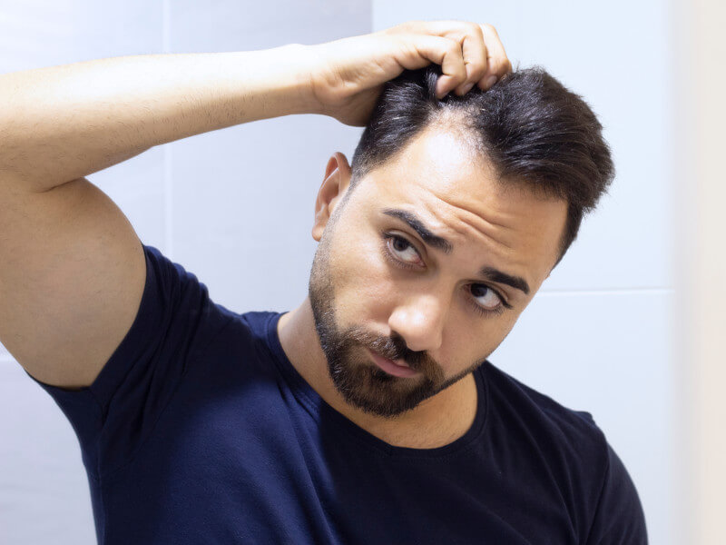 man worried about hair loss
